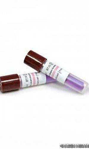 indicador biológico bionova bt20 indicador biológico bionova bt20